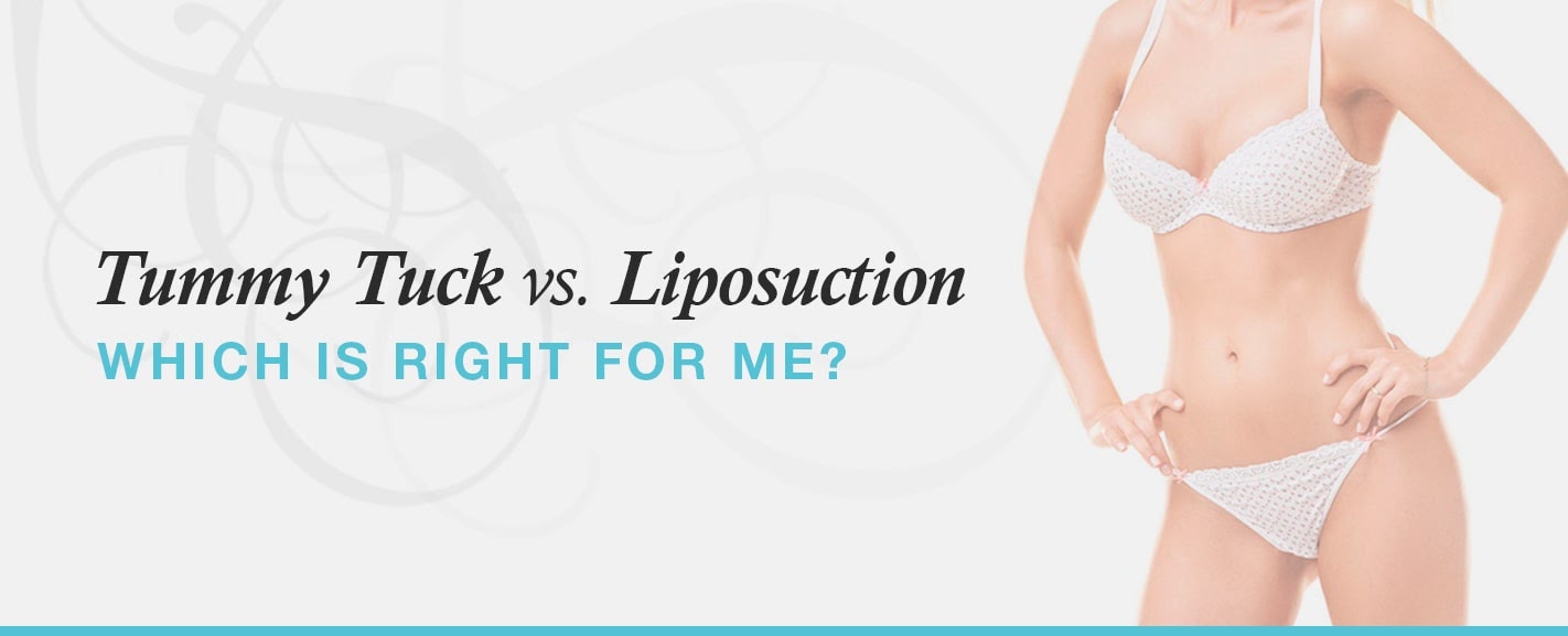 Tummy-tuck-vs-liposuction-which-is-right-for-me